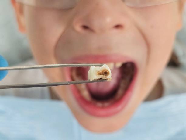 Best Urgent Care for Lost Fillings or Crowns in Sullivan Gardens, TN